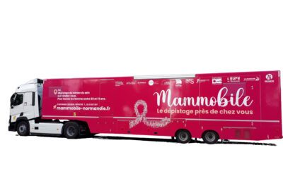 Le Mammobile sur  la route pour dépister le cancer du sein